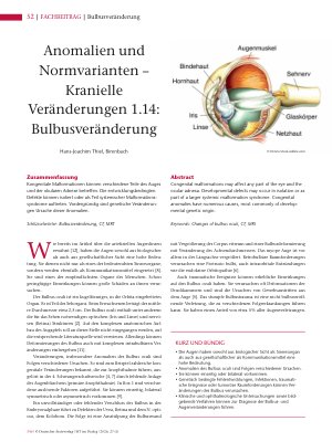 Vorschauseite 1: Anomalien und Normvarianten – Kranielle Veränderungen 1. 14: Bulbusveränderung