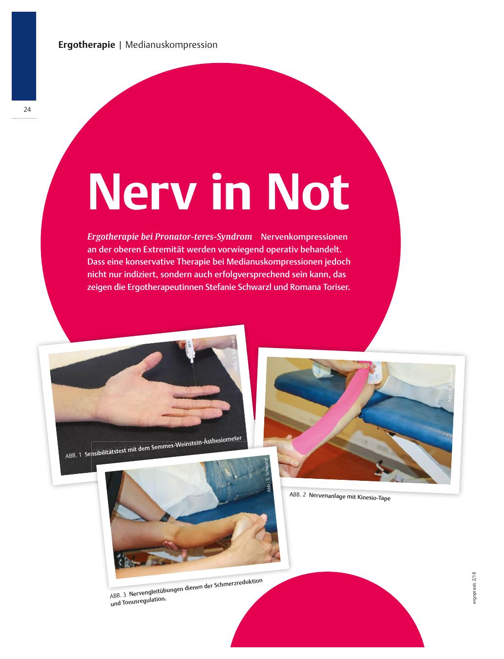 Vorschauseite 1: Ergotherapie bei Pronator-teres-Syndrom ? Nerv in Not