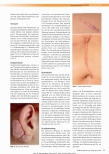 Vorschauseite 3: Aktuelle Therapieempfehlungen pathologischer Narben: Hypertrophe Narben und Keloiden