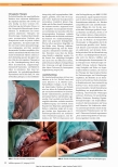 Vorschauseite 4: Aktuelle Therapieempfehlungen pathologischer Narben: Hypertrophe Narben und Keloiden
