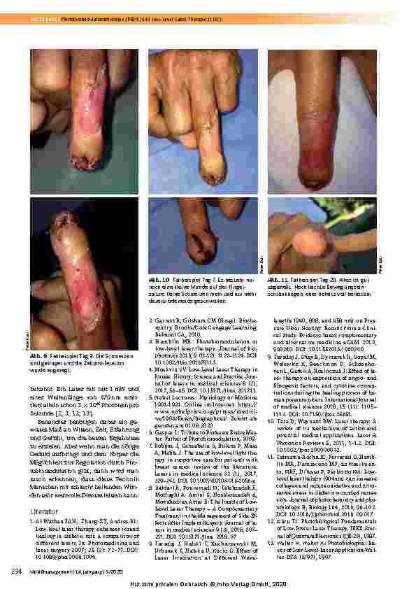 Vorschauseite 6: Photobiomodulationstherapie (PBMT) und Low-Level-Laser-Therapie (LLLT)