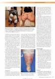 Vorschauseite 4: Adipositas und chronische Wunden