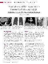 Vorschauseite 1: Anomalien und Normvarianten – Interne Veränderungen 2. 23: interne vaskuläre Malformationen