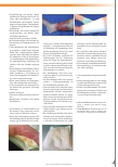 Vorschauseite 2: Vlieskompressen mit Superabsorber – Indikationen, Eigenschaften und Anwendungstipps