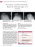 Vorschauseite 1: Anomalien und Normvarianten – Skelettale Veränderungen 3.13 Patelladysplasie