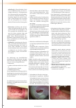 Vorschauseite 2: Hautschädigungen durch klebende Verbandmittel