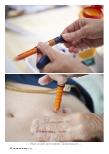 Vorschauseite 1: Wissenswertes über die Insulintherapie