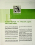 Vorschauseite 1: Radiochirurgie®: Mit Strahlen gegen Hirnmetastasen