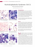 Vorschauseite 1: Myelodysplastische Syndrome (Teil 2) MDS ohne Blastenvermehrung