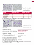 Vorschauseite 4: COVID-19 und die morphologischen Veränderungen der Zellen im peripheren Blutausstrich