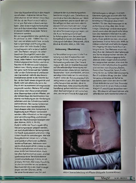 Vorschauseite 5: Der Kock-Pouch (kontinentes Ileostoma) - das wiederentfachte Interesse an einem alten Verfahren