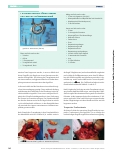 Vorschauseite 3: Chirurgie des Mundhöhlenkarzinoms – Resektion und Rekonstruktion