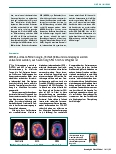 Vorschauseite 2: Aktuelle Empfehlungen der European Academy of Neurology zur Beurteilung von schweren Bewusstseinsstörungen und Koma