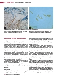 Vorschauseite 3: Schimmelpilze Teil 1: Dematiaceae Auch „Schwärzepilze“ genannt