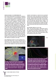 Vorschauseite 3: Individualisierung in der Strahlentherapie des primären Prostatakarzinoms