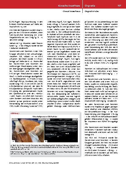 Vorschauseite 4: Ultraschallgesteuerte, kontinuierliche thorakale „Erector Spinae Plane“-Blockade bei anterolateralen Thorakotomien in der Herzchirurgie: Eine retrospektive, patientengepaarte Vorh…