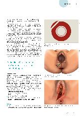 Vorschauseite 4: Ein Update zum Thema Endoskoptome.