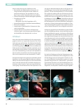 Vorschauseite 4: Die operative Therapie von Kraniosynostosen