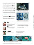 Vorschauseite 5: Die operative Therapie von Kraniosynostosen