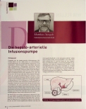 Vorschauseite 1: Die hepato-arterielle Infusionspumpe