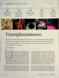 Vorschauseite 1: Transplantationen