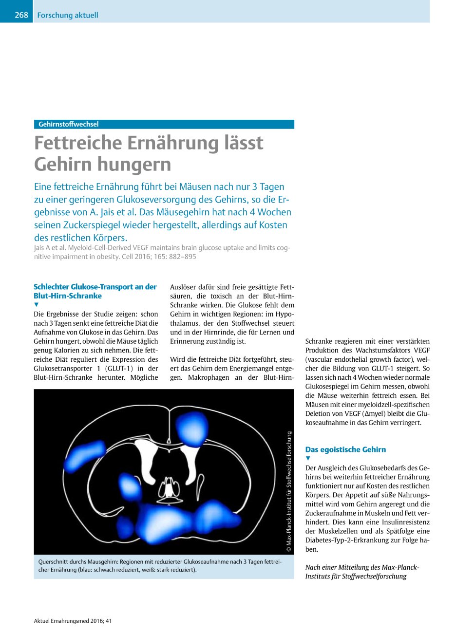 Vorschauseite 1: Gehirnstoffwechsel – Fettreiche Ernährung lässt Gehirn hungern