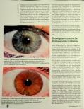 Vorschauseite 3: Die vegetativ-spastische Diathese. Vegetative Spastik: Diathese oder Disposition?