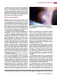 Vorschauseite 4: Pest: Die Katastrophe des Mittelalters. Heute nur noch eine historische Infektionskrankheit in Europa?