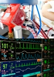 Vorschauseite 1: Herausforderungen an die moderne Intensivpflege