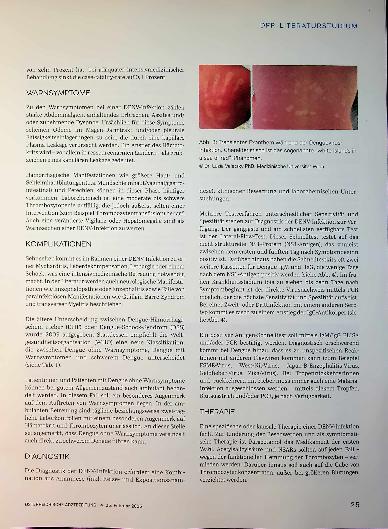 Vorschauseite 6: Denguevirus Infektionen