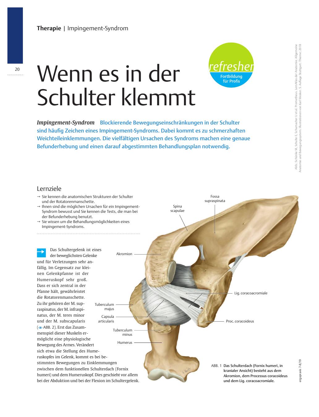 Vorschauseite 1: Wenn es in der Schulter klemmt ? Impingement-Syndrom