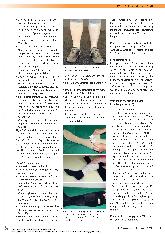 Vorschauseite 2: Phlebologische Kompressionstherapie, Teil 2: Versorgungsoptionen in den einzelnen Therapiephasen