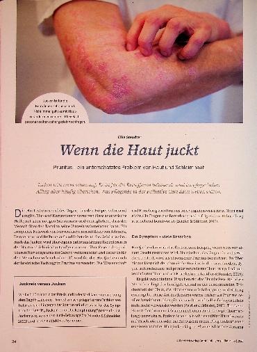 Vorschauseite 1: Wenn die Haut juckt Pruritus - ein unterschätztes Problem von Haut und Schleimhaut