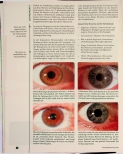 Vorschauseite 2: Miasmen im Auge Teil 2: Tuberkulinie