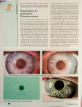 Vorschauseite 2: Bitter und süße - die Bauchspeicheldrüse als polares Organ. Ihre Darstellung im Auge - Teil 1.