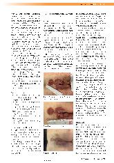 Vorschauseite 2: Kutane Leishmaniose - eine Herausforderung für Dermatologen und Wundmanager