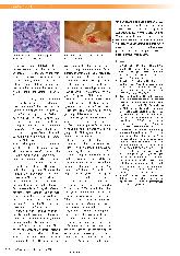 Vorschauseite 3: Kutane Leishmaniose - eine Herausforderung für Dermatologen und Wundmanager