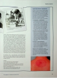 Vorschauseite 2: Lyme, Borrelia & Burgdorferi