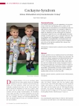 Vorschauseite 1: Cockayne-Syndrom: Seltene Erbkrankheit mit fortschreitendem Verlauf.