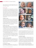 Vorschauseite 3: Cockayne-Syndrom: Seltene Erbkrankheit mit fortschreitendem Verlauf.