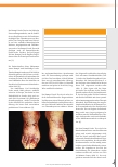 Vorschauseite 1: Diagnostische Methoden – die Serie zum Sammeln Der Rumpel-Leede-Test – Update 2021