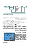 Vorschauseite 3: Wenn das Gehirn aus den Fugen gerät