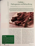 Vorschauseite 1: Cellulite - Pathogenese und Behandlung