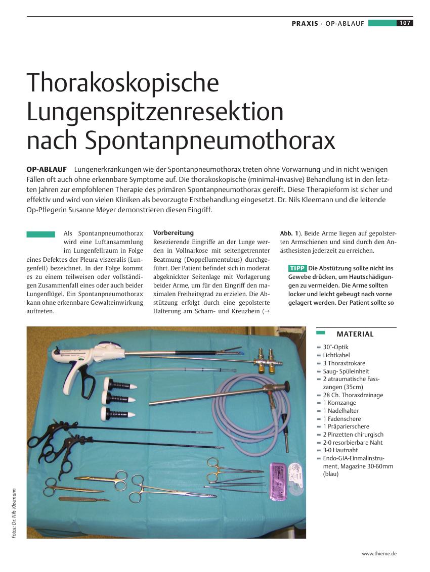 Vorschauseite 1: Thorakoskopische Lungenspitzenresektion nach Spontanpneumothorax