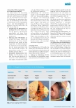 Vorschauseite 4: COVID-19-Pandemie: Ein erfolgreich implementiertes gemischtes Aufbereitungsprotokoll für N95-Atemschutzmasken unter Krisenbedingungen