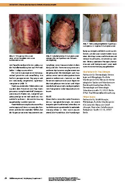 Vorschauseite 3: Plattenepithelkarzinom bei irritativer Kontaktdermatitis