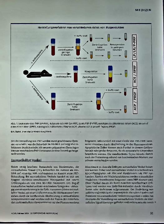 Vorschauseite 2: Blutderivate bei Arthrose