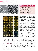 Vorschauseite 3: Malassezia-Hefen (Teil 1) Kommensale und Krankheitserreger - eine Übersicht