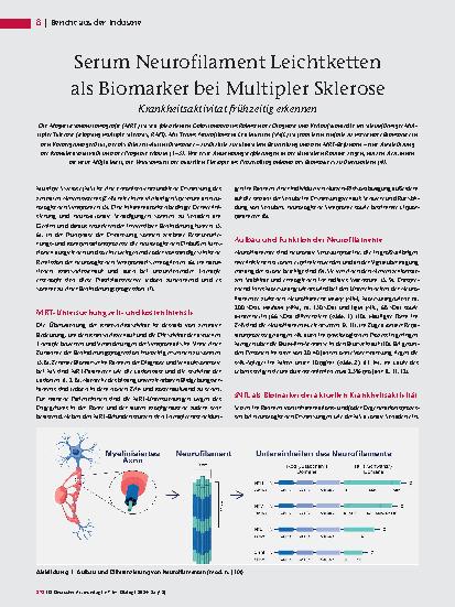Vorschauseite 1: Serum-Neurofilament-Leichtketten als Biomarker bei Multipler Sklerose-Krankheitsaktivität frühzeitig erkennen.