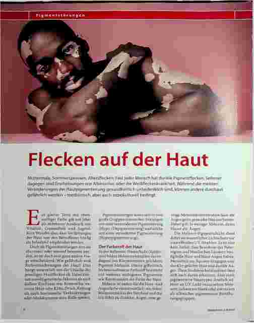 Vorschauseite 1: Flecken auf der Haut
